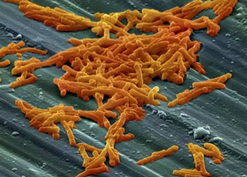 梭状芽胞杆菌疫情暴发 元凶是艰难梭菌
