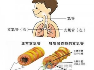 运动性哮喘吃什么药？郑州那家医院治疗运动性哮喘好？招商